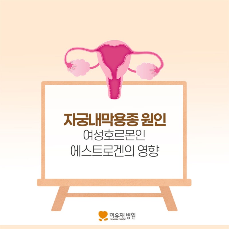 자궁내막용종 원인, 여성호르몬인 에스트로겐의 영향