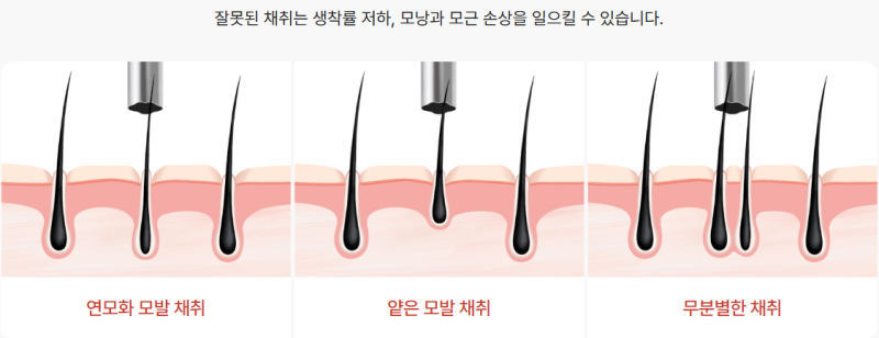 부산 비절개 모발이식, 절개와 무엇이 다른지 제대로 알아야 합니다