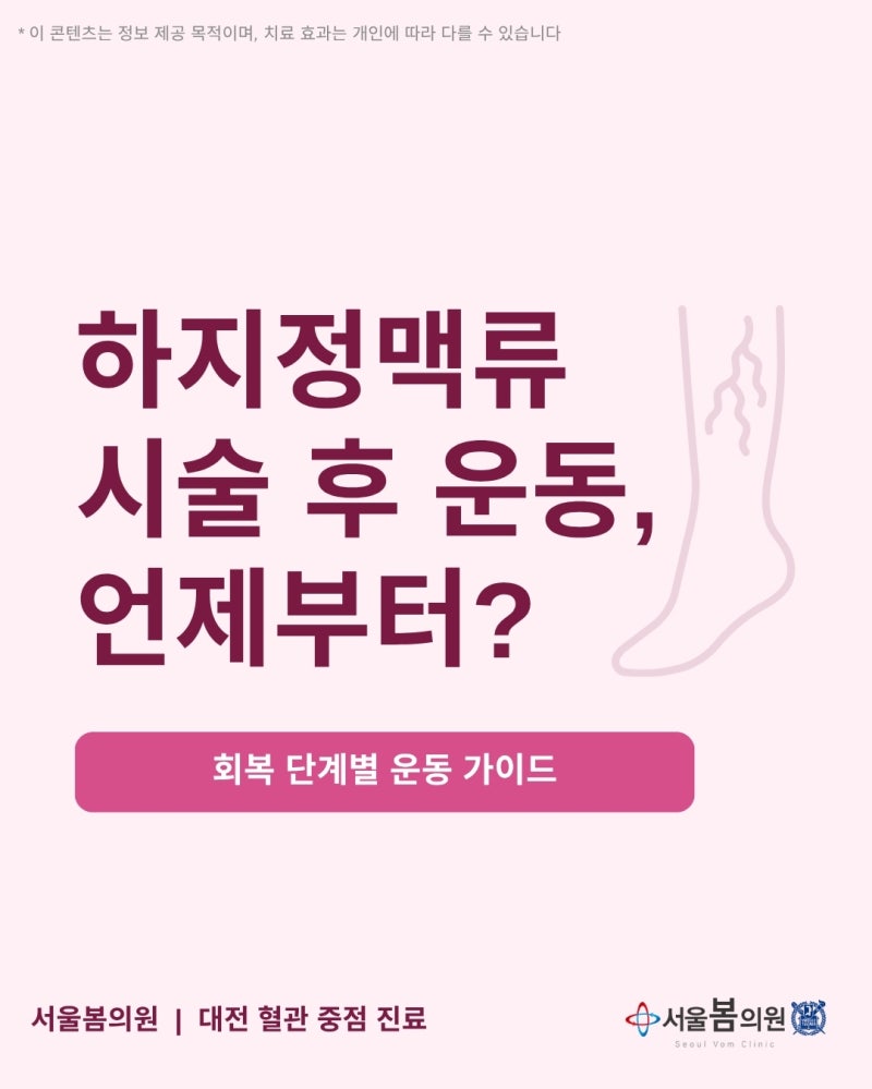 대전 하지정맥류 시술 후 운동, 언제부터 가능할까요? | 서울봄의원