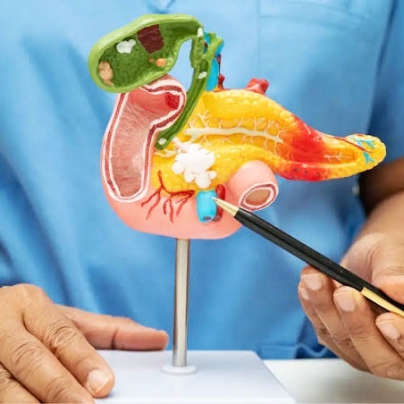 췌장 검사 방법 알아보기, (CT, MRI 검사 차이점)