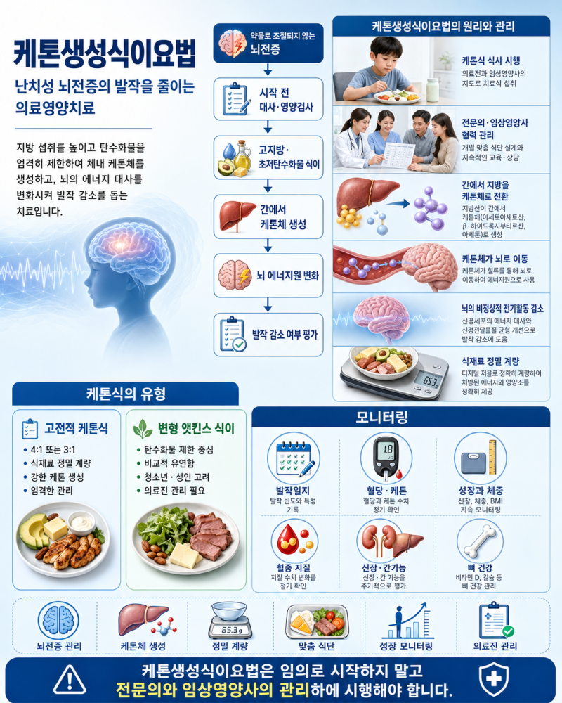 케톤생성식이요법, 약물로 조절되지 않는 난치성 뇌전증 치료에 사용하는 고지방 식이요법