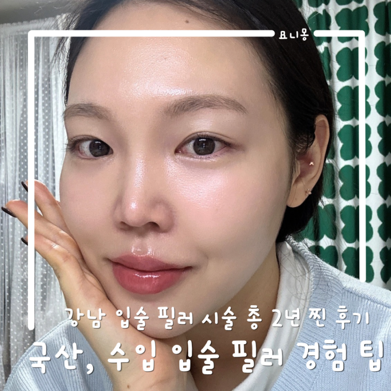입술 필러 수입, 국산 시술 3년 경험하고 작성하는 꿀팁 후기! (가격, 붓기, 유지 기간)