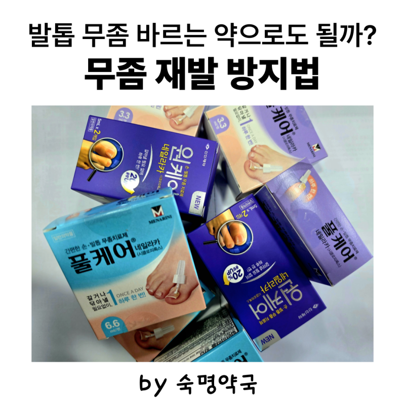 샌들 신으려는데 발톱이 두껍고 노랗다면? 여름철 발톱무좀 관리법ㅣ발톱무좀 재발ㅣ풀케어....