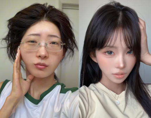 "설마 결혼한 지 석 달 만에 또 성형을 한다고요?" 최준희의 깜짝 근황에 네티즌들 깜짝 놀란 ....