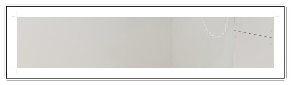 부천치과추천 임플란트 CT 촬영으로 정밀 진단부터