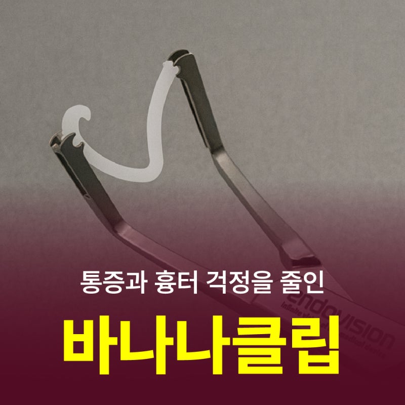 부산 치질 통증과 흉터 걱정 줄인 바나나클립 수술의 회복 기간