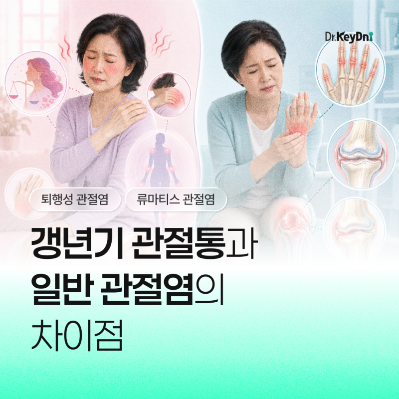 갱년기 관절통과 일반 관절염은 어떻게 다를까?