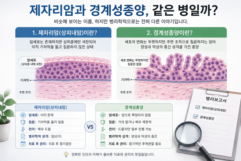제자리암과 경계성종양 차이, 같은 병일까? 병리학적으로 쉽게 정리....