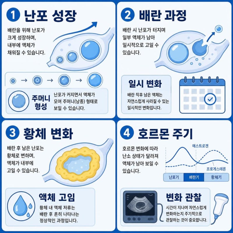 난소에 물혹이 있으면 무조건 수술해야 하나요?