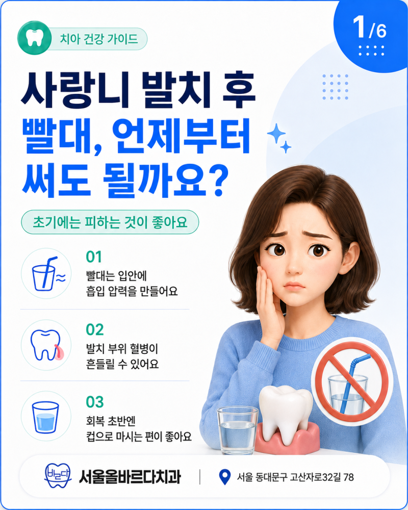 전농SK아파트치과 사랑니 발치 후 빨대는 언제부터 써도 될까요