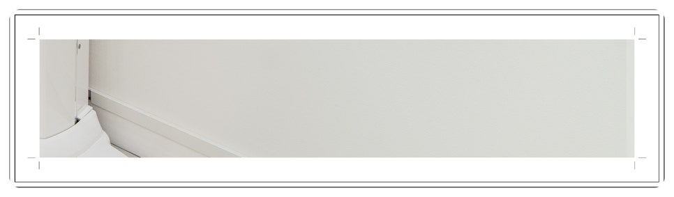 부천치과추천 임플란트 CT 촬영으로 정밀 진단부터