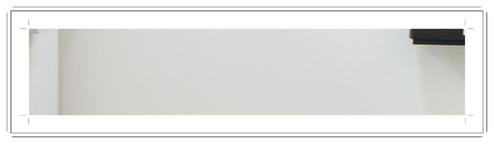부천치과추천 임플란트 CT 촬영으로 정밀 진단부터