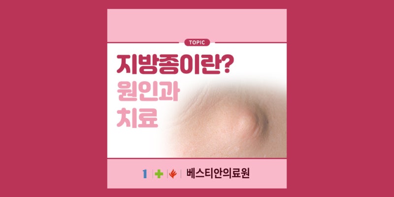 지방종이란? 원인부터 제거가 필요한 경우 및 병원 정보