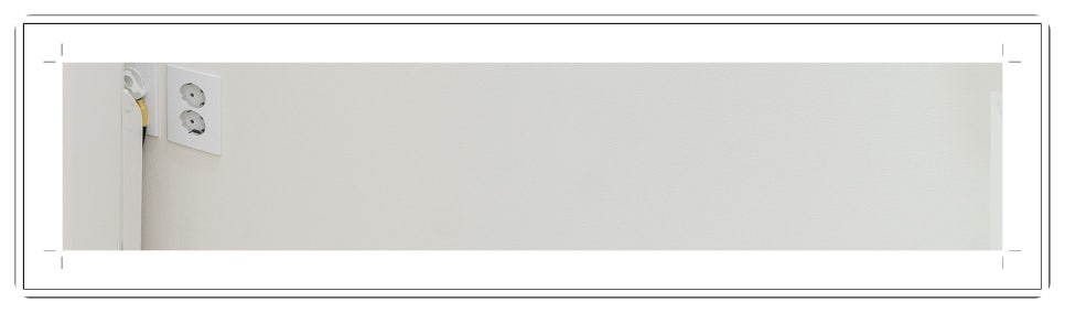 부천치과추천 임플란트 CT 촬영으로 정밀 진단부터