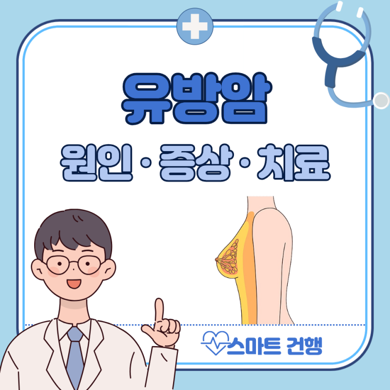 유방암 초기 전조 증상, 원인, 치료 : 2기 3기 4기 생존율