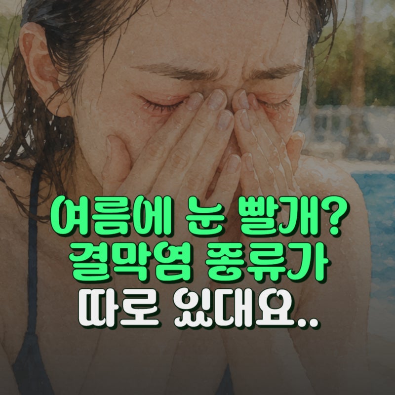 여름마다 재발하는 결막염 증상 3가지 종류와 빨리 낫는 방법