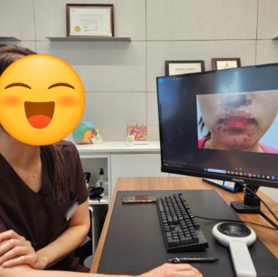 부산 홍조 치료, 두드러기/피부염까지 5년 넘게 재발된 50대 여성 Case..