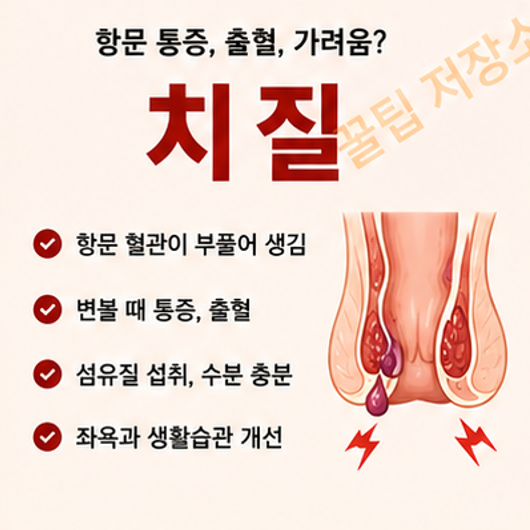 치질이란? 원인, 증상 및 예방방법