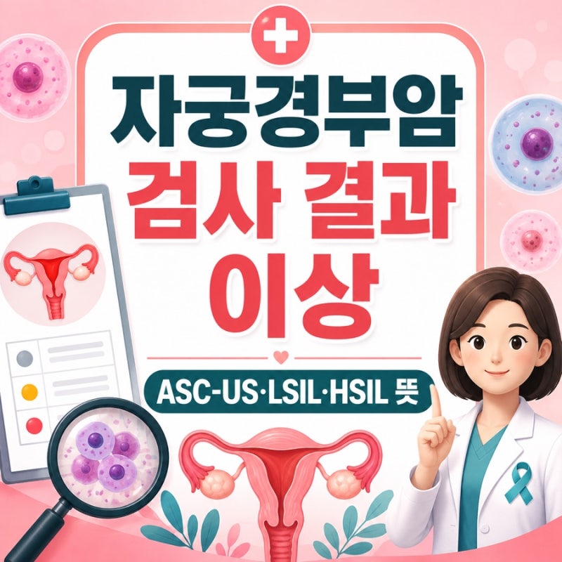 자궁경부암 검사 결과 이상, ASC-US·LSIL·HSIL 뜻과 차이