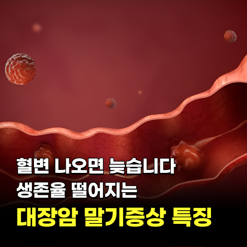 "혈변 나오면 늦습니다.." 생존율 떨어지는 대장암 말기증상 특징