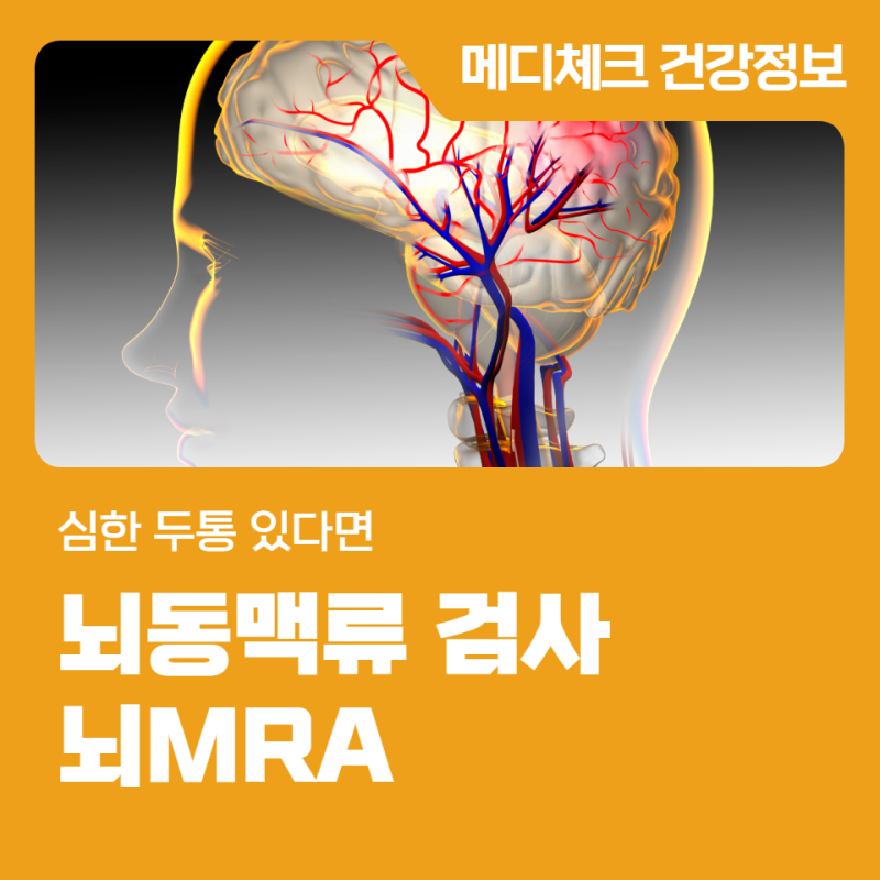 경남건강관리협회 뇌동맥류 검사 뇌MRA 심한 두통 있다면