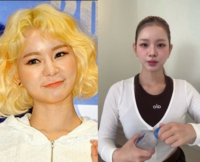 "12년 만에 성형 고백" 맹승지, 인중 줄이고 싹 바뀐 최근 얼굴 근황