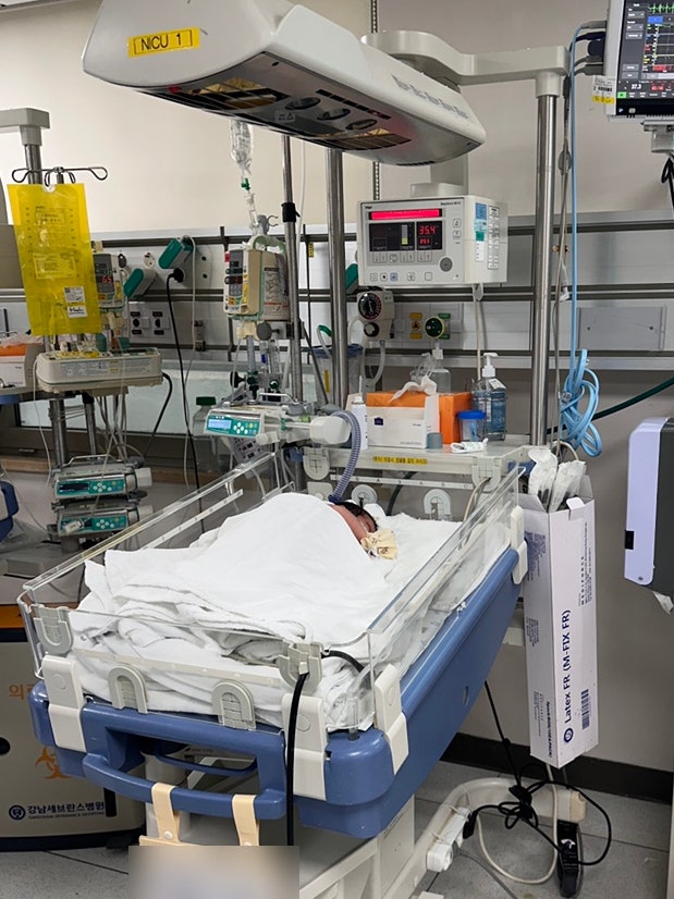 신생아 일과성 빈호흡으로 강남세브란스 신생아중환자실 NICU 전원, 기흉 흉관삽입까지 8일만....