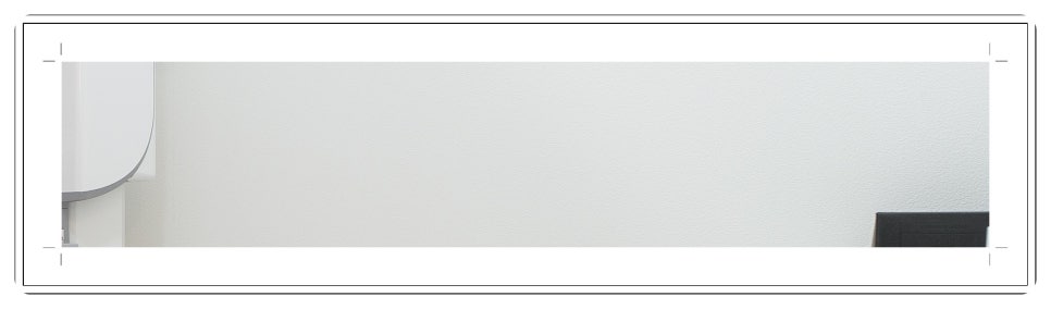 부천치과추천 임플란트 CT 촬영으로 정밀 진단부터
