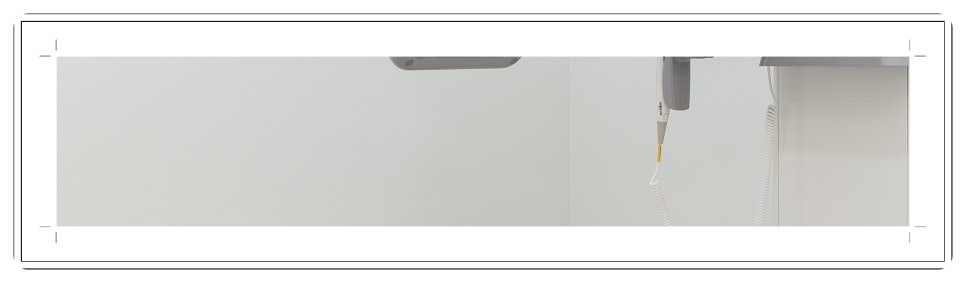 부천치과추천 임플란트 CT 촬영으로 정밀 진단부터