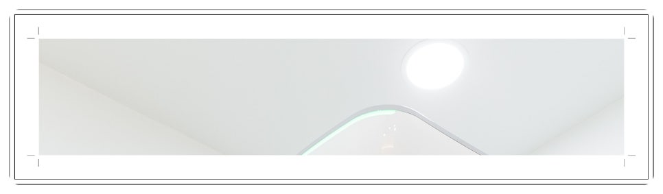 부천치과추천 임플란트 CT 촬영으로 정밀 진단부터