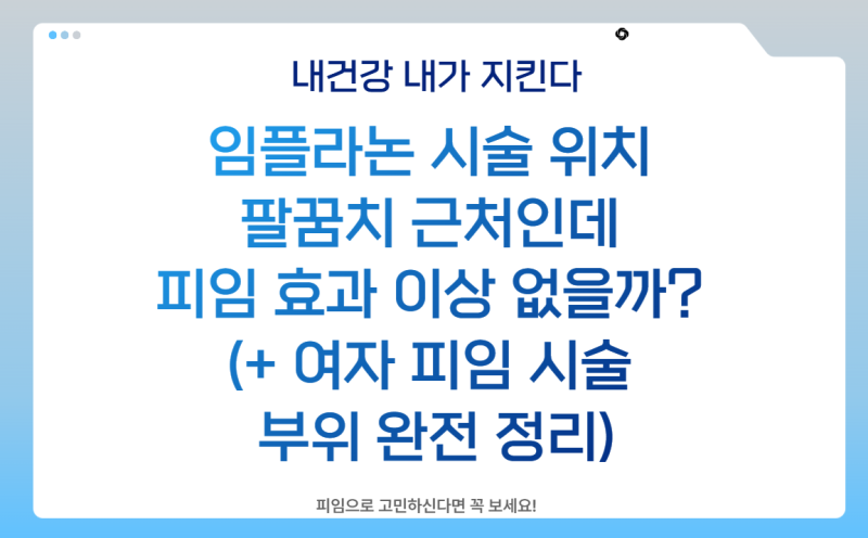 임플라논 시술 위치 팔꿈치 근처인데 피임 효과 이상 없을까? (+ 여자 피임 시술 부위 완전 정....