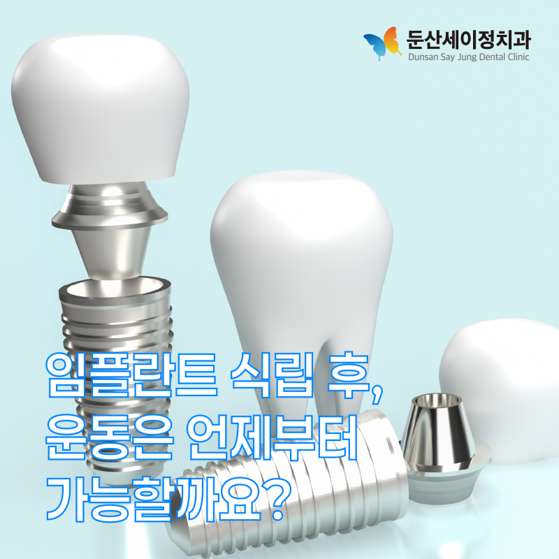 둔산치과 임플란트 식립 후, 운동은 언제부터 가능할까요?
