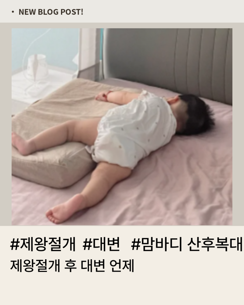 제왕절개 후 대변 언제, 조리원 언니 꿀팁