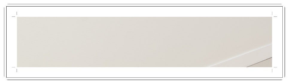 부천치과추천 임플란트 CT 촬영으로 정밀 진단부터