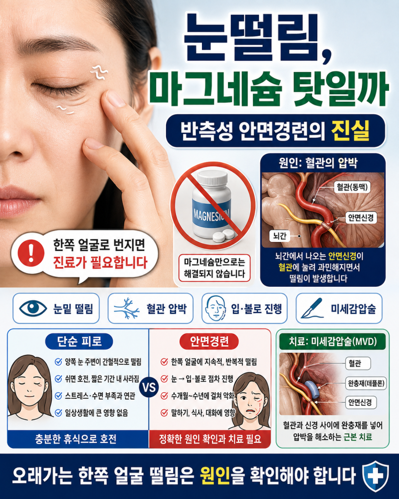 눈떨림 마그네슘 부족인 줄 알았는데 안면경련? 원인부터 미세감압술까지