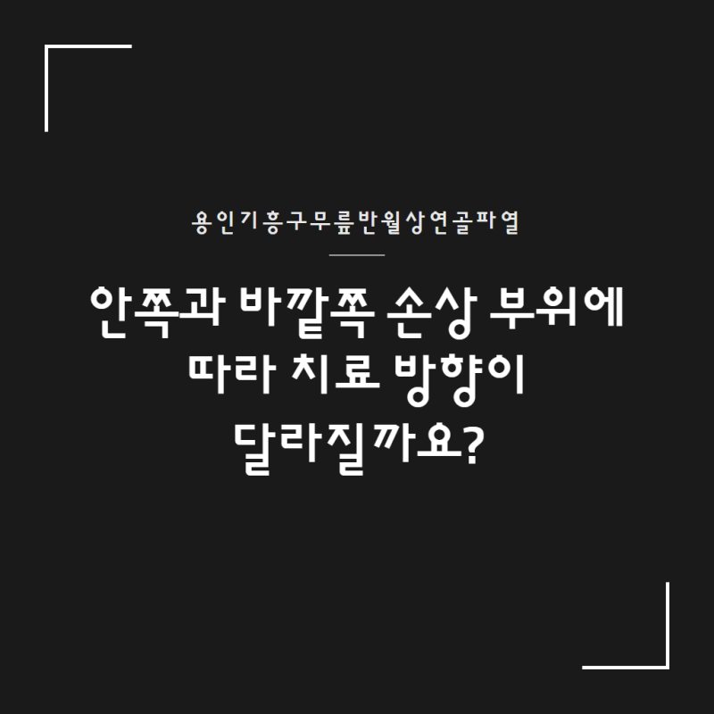 용인기흥구무릎반월상연골파열, 안쪽과 바깥쪽 손상 부위에 따라 치료 방향이 달라질까요?