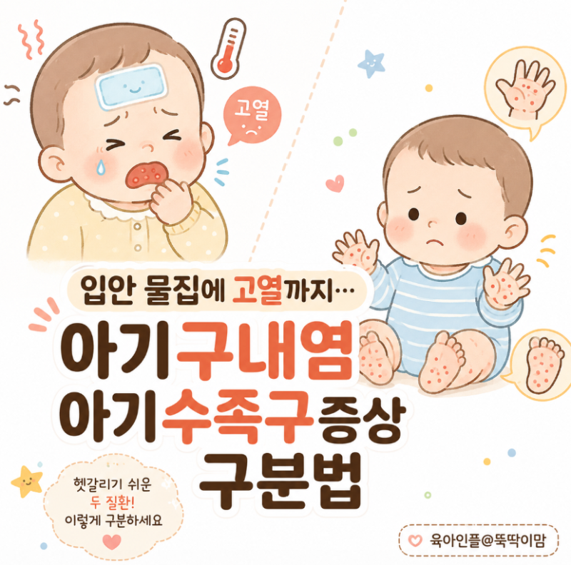 입안 물집에 고열까지… 아기구내염 아기수족구증상 구분법