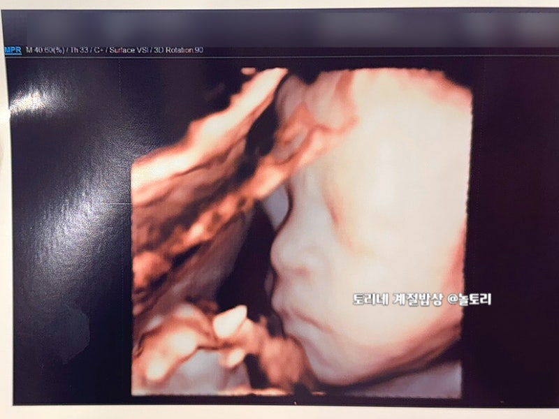 폭염특보에 병원 다녀온 경기도 임산부라면? 최대 10만원 지원!