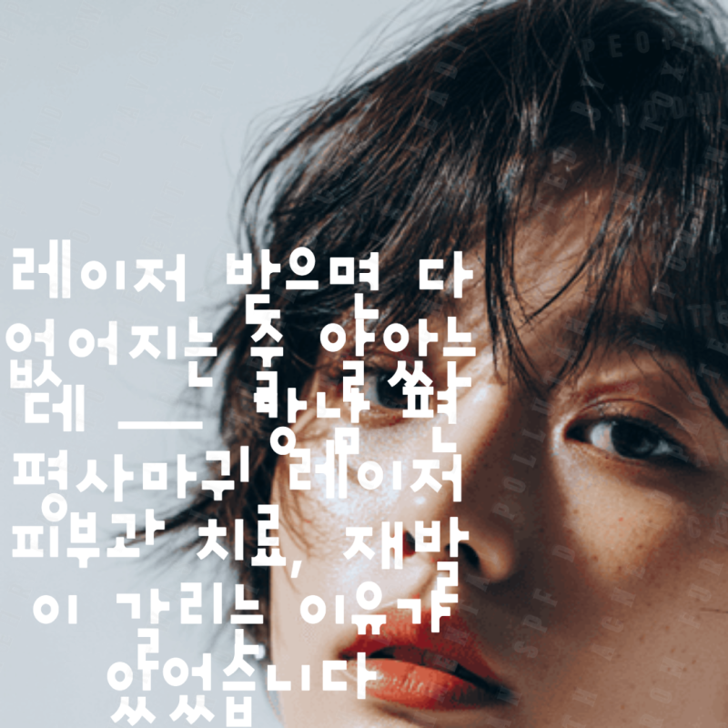 레이저 받으면 다 없어지는 줄 알았는데 — 강남 편평사마귀 레이저 피부과 치료, 재발이 갈....