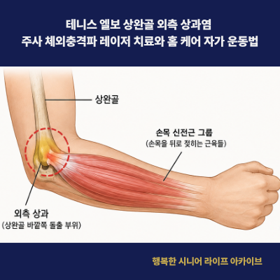 테니스 엘보 상완골 외측 상과염 주사 체외충격파 레이저 치료와 홈 케어 자가 운동법