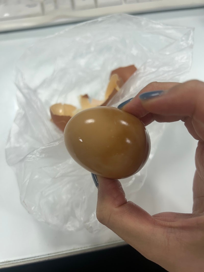 마운자로 부작용 기록 | 위가 약한 사람이 5mg 맞으면 생기는 일, 메스꺼움·구토 대처법과 상....