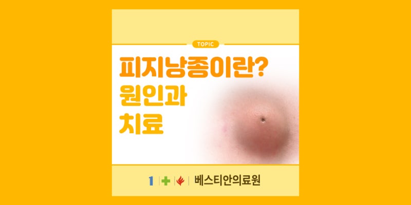 피지낭종 증상과 원인, 제거 및 병원 선택과 치료가 중요한 이유