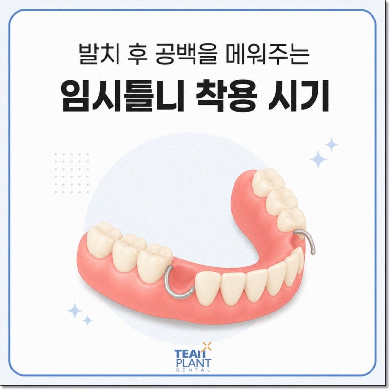 임시틀니, 최종 보철물 완성 전 착용 및 관리법