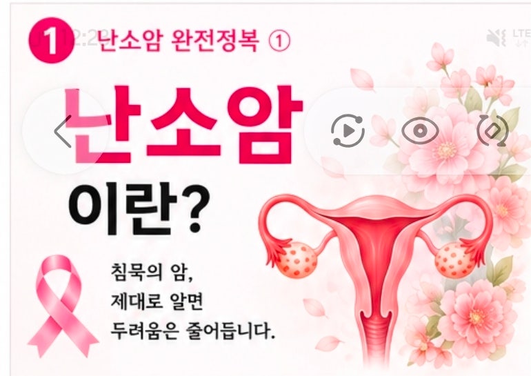난소암이란? 난소암의 정의부터 종류, 치료까지 한눈에 이해하기 | 난소암 완전정복 ①