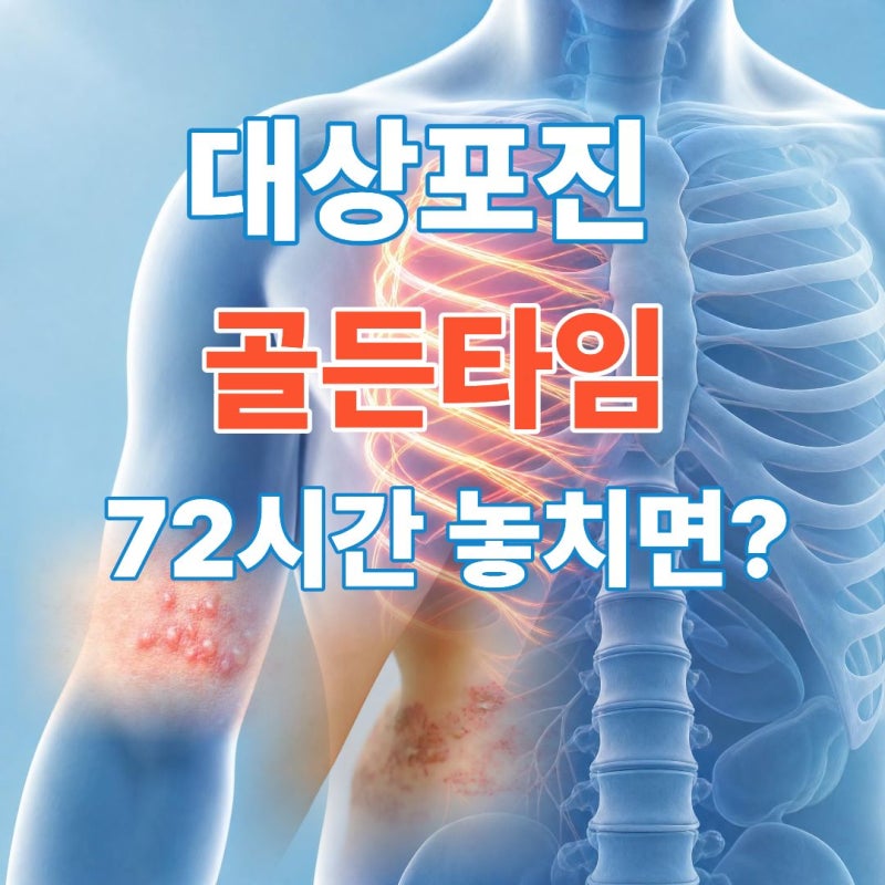 대상포진 초기 증상과 전염성 완벽 정리! 골든타임 72시간과 최신 치료법·백신 비교