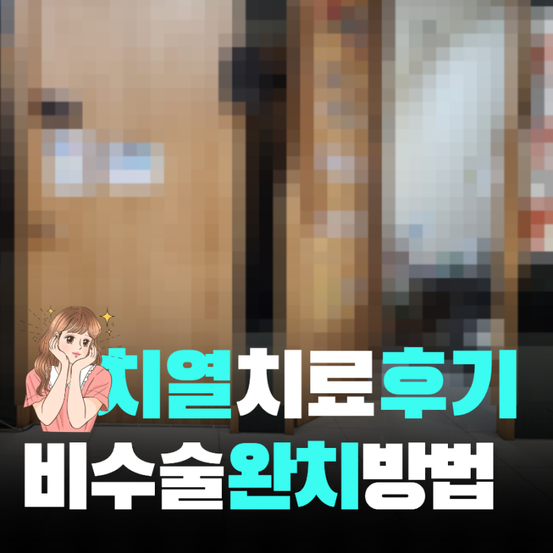 치열 치료 후기 2년 재발 끝낸 비수술 관리법