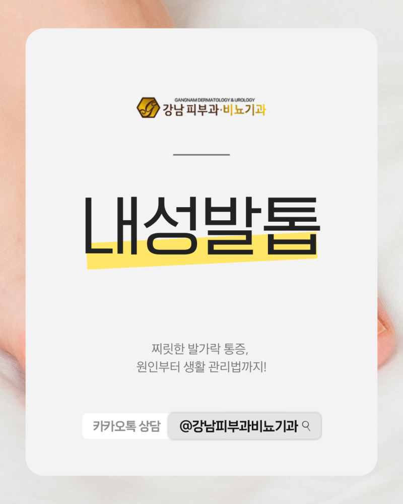 내성발톱원인 초기 통증 잡는 관리 방법부터 올바른 습관까지