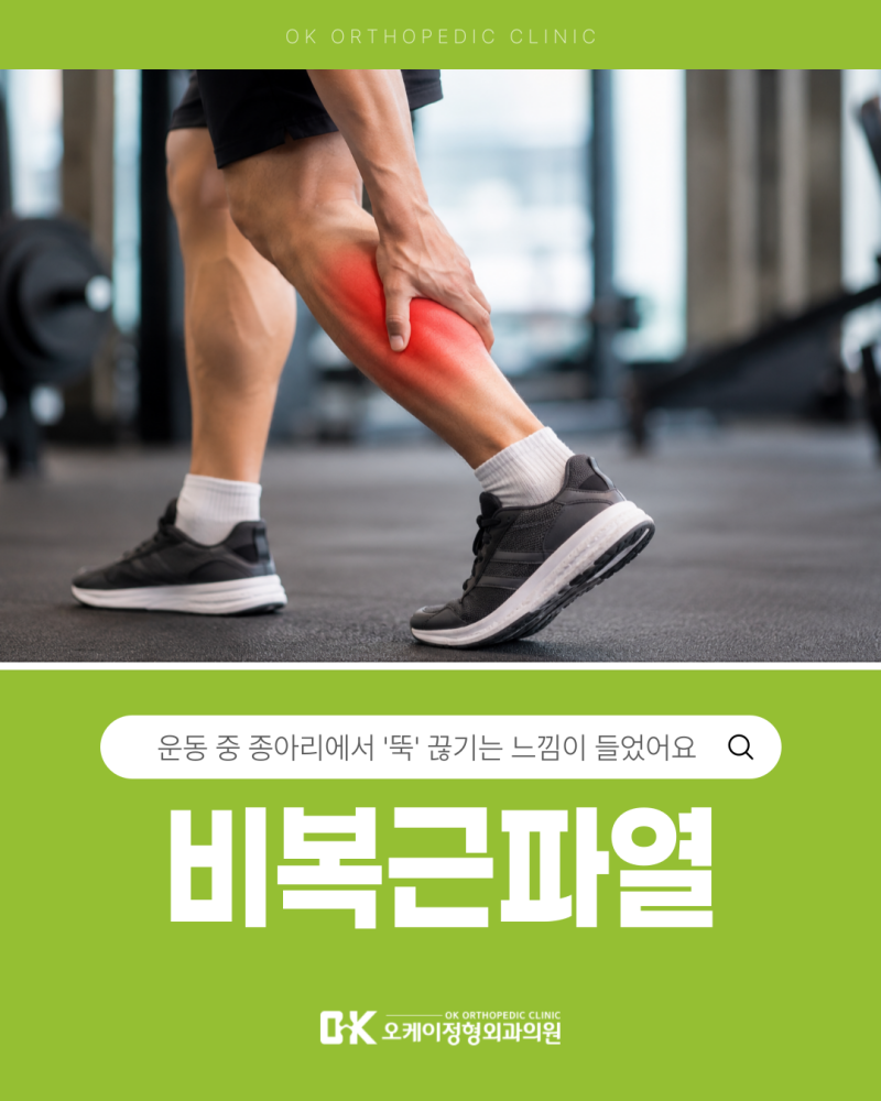 비복근 파열, 운동 중 종아리 뚝 끊기는 느낌이 들었어요 종아리 근육 파열 원인과 증상 알아....