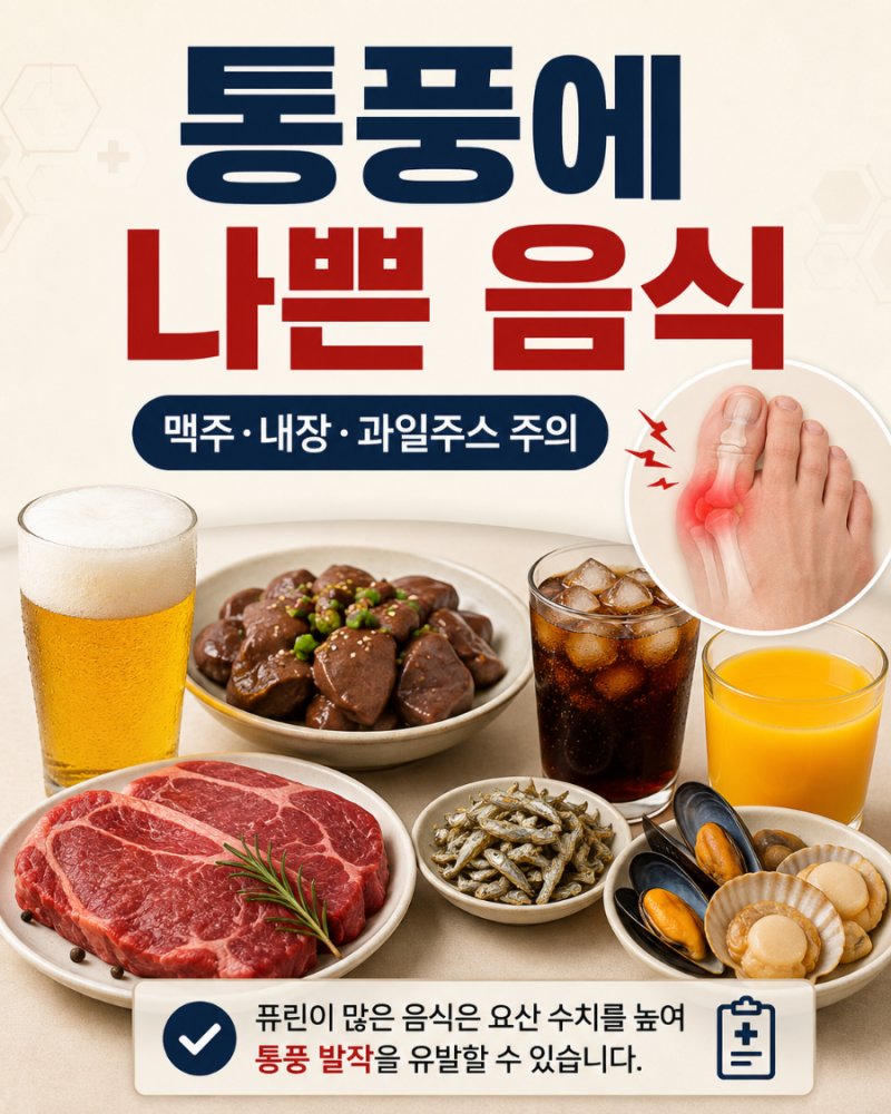 통풍에 나쁜 음식 7가지 맥주·내장·과일주스까지 꼭 줄이세요
