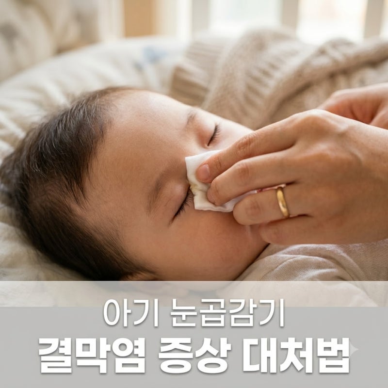 아기 눈곱감기 증상 유행성 결막염 구분법과 여름철 대처 가이드
